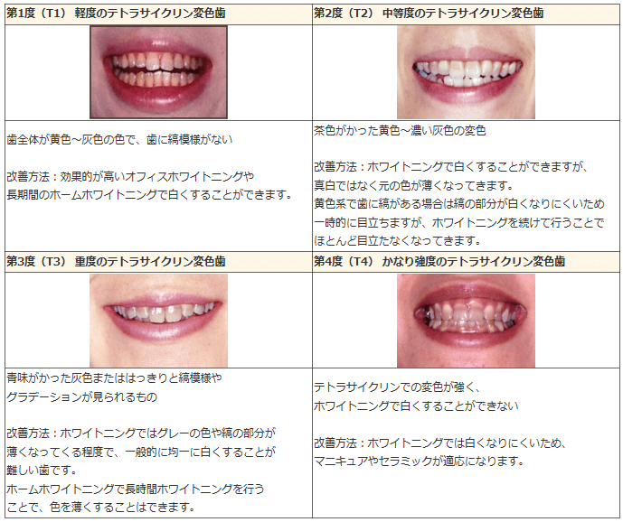 歯 白く する