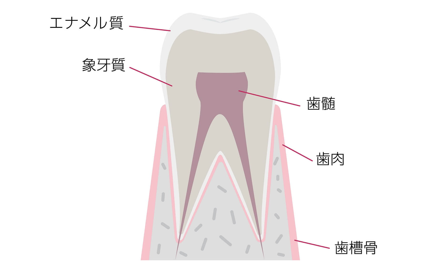 ホワイトニングで歯がしみる理由