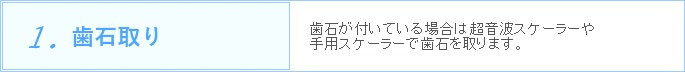 1.歯石取り