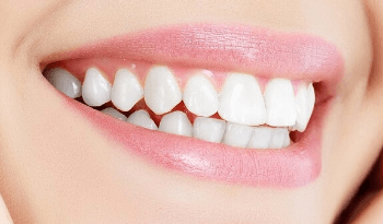 すでにある程度歯が白い場合