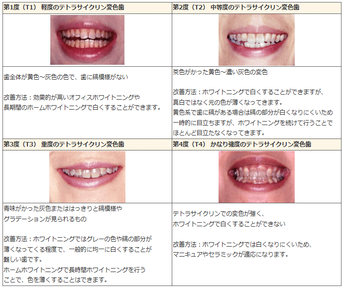 テトラサイクリン歯の表