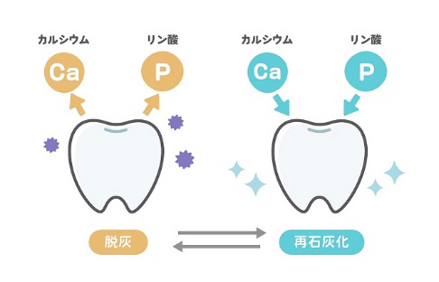 ホワイトニングは歯を傷めます2