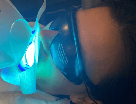 ZOOM Teeth Whitening process